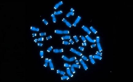 Ven viable reducir efectos del Síndrome de Down