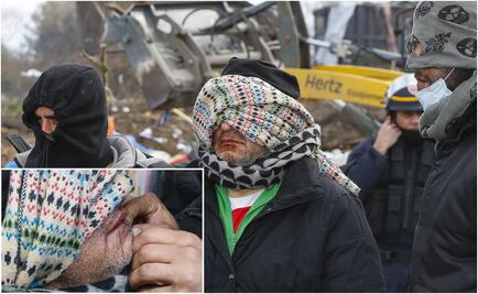 Refugiados se cosen la boca como protesta en Calais