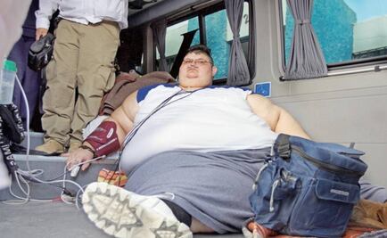 Obese man to undergo live-saving treatment in Jalisco