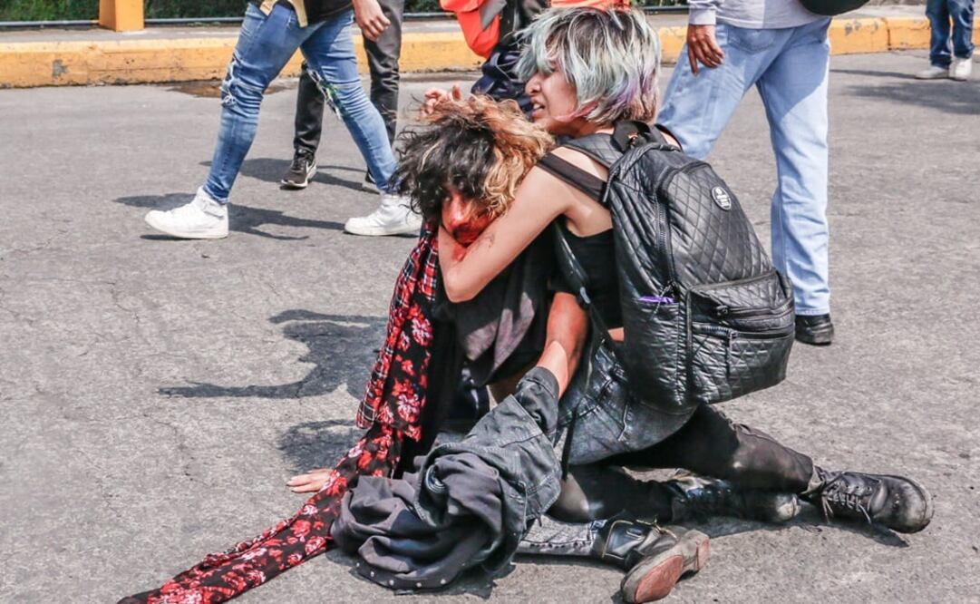 Supuestos porros que estaban en Rectoría golpearon y picaron con un arma a Joel Meza. (FOTO: cortesía Diego Uriarte)