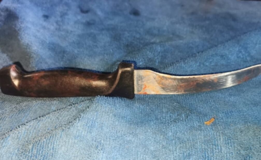 Menor de 15 años mata a puñaladas a conductor de Didi en Iztapalapa