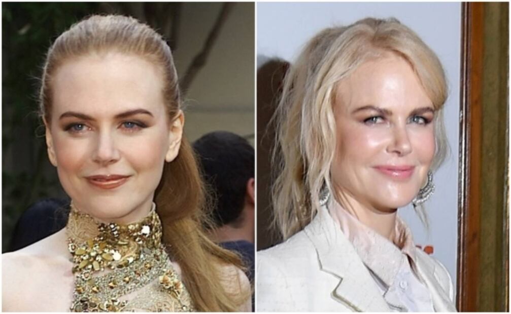 Los rostros de Lis Vega, ​​​​​​​Reneé Zellweger y Nicole Kidman quedaron ¡irreconocibles!
