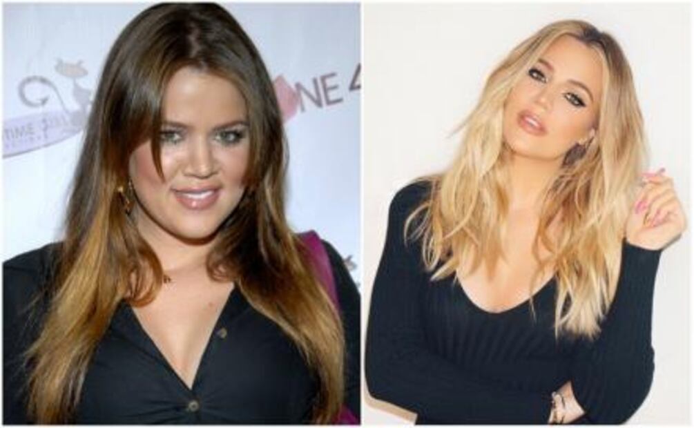 Khloé Kardashian y su transformación 