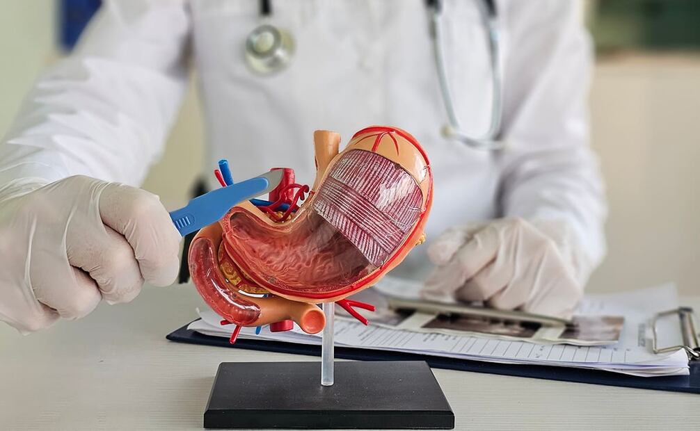 Aunque la cirugía bariátrica es ideal para bajar de peso, es necesario perder algunos kilos para hacer efectiva la operación. Foto: Cortesía