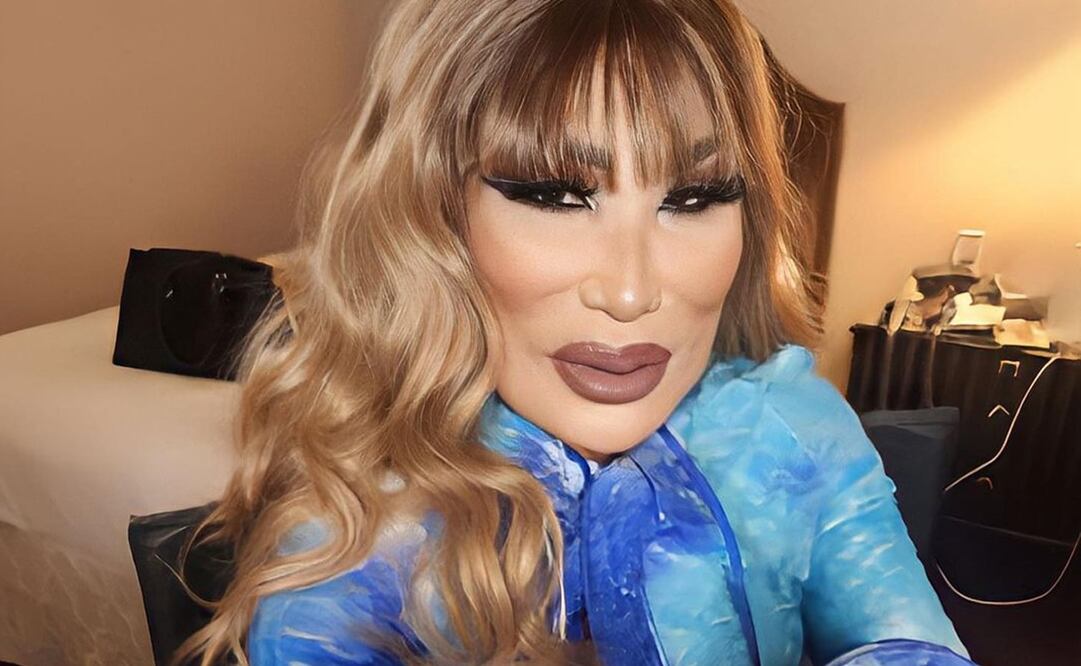 La vedette contó a detalle el supuesto procedimiento estético que lesionó su rostro. Foto: Instagram