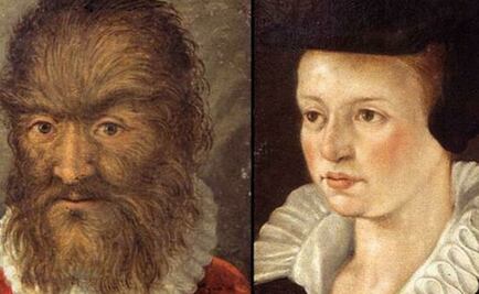 La historia del hombre lobo que inspiró el cuento de "La Bella y la Bestia"