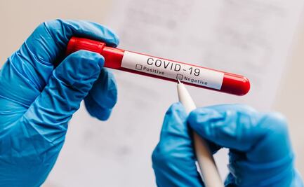 Usan pruebas falsas de Covid-19 para poder viajar a otros países