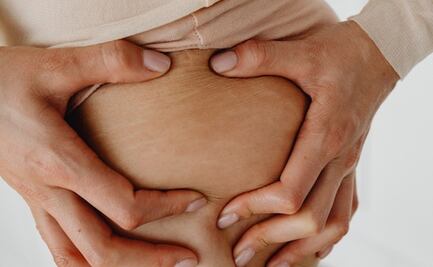 Exfoliantes caseros con azúcar para atenuar las estrías