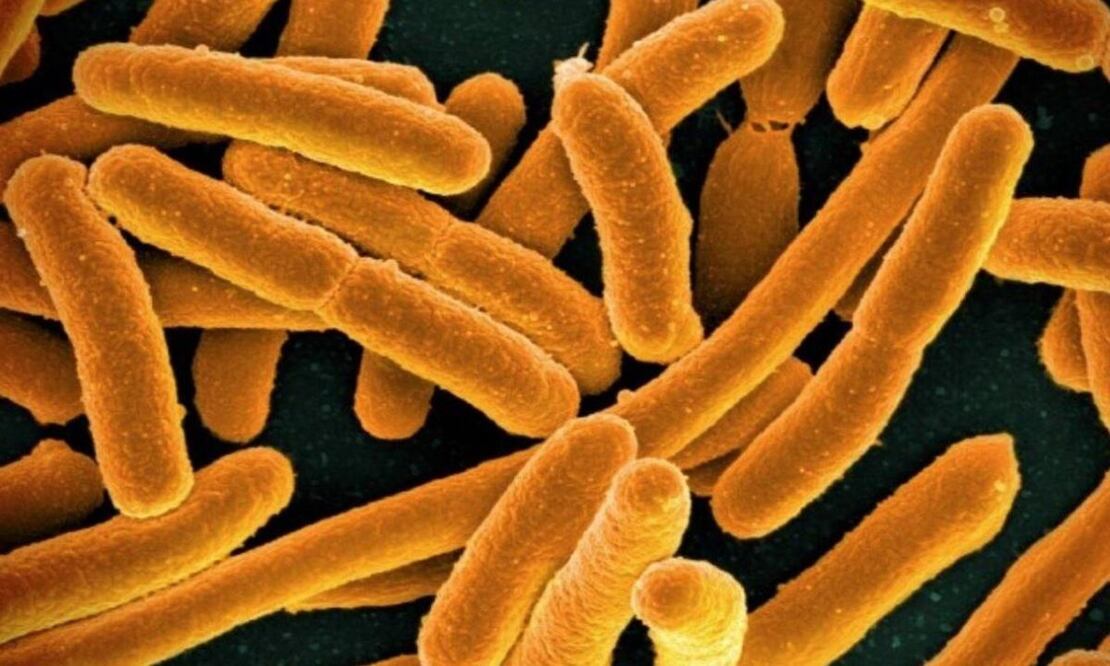 La 'Vibrio vulnificus' es una bacteria que se alimenta de carne humana y vive en aguas marinas cálidas. FOTO: NATIONAL INSTITUTES OF HEALTH