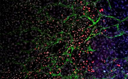 Descubren técnica rápida para conseguir células madre más eficientes