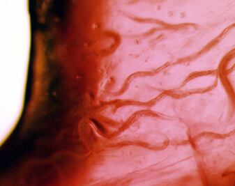 Descubren que olfato superdesarrollado de un gusano detectaría el cáncer de páncreas oportunamente 