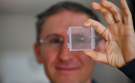 Insertan microrobots en el cráneo para curar enfermedades cerebrales