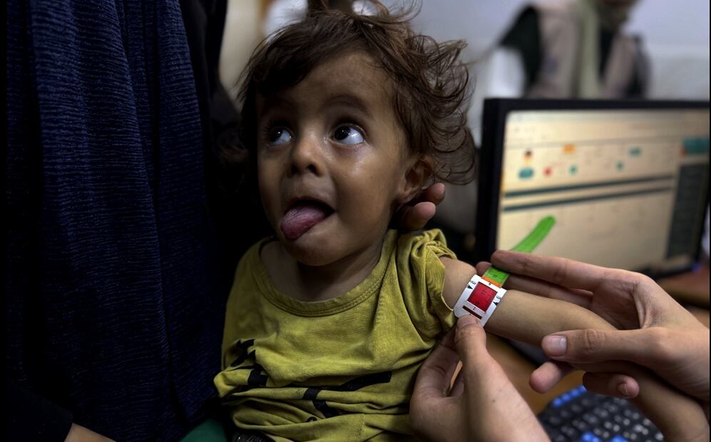 El Hospital de la Sociedad Benéfica de Amigos del Paciente de Ciudad de Gaza está atestado de madres ojerosas y niños cabezudos con cuerpos demasiado pequeños, ojos hundidos, tripas hinchadas y brazos diminutos. El centro pediátrico trata la desnutrición en el norte de la Franja de Gaza, donde la hambruna cobra cada día más vidas, la mayoría niños. Foto: EFE