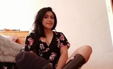 IMSS atiende recomendación en caso de mujer que le amputaron las piernas; reconoce compensación