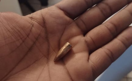 Mujer resulta lesionada de un disparo mientras realizaba compras en una farmacia de la alcaldía Coyoacán